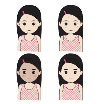 Facial skin problems Illustrazione stock