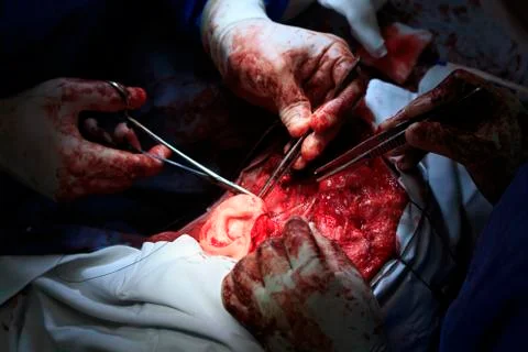 Facial surgery Фото