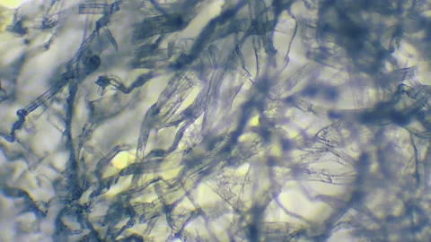 Facial Tissue under a Microscope Stock Footage 153451431
