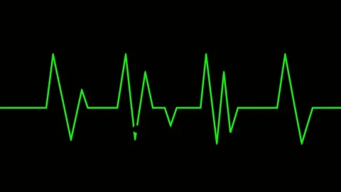 Fading Heartbeat Line Animation with Smooth In-and-Out Visibility Stock Footage 321646155
