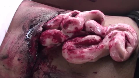 Fake wound for learning in simulation training Video stock 131587818