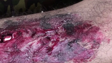 Fake wound on the leg for learning in simulation training Stock Footage