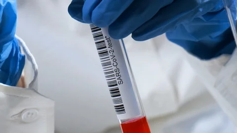 Falling Drops of blood from a pipette into a test tube SARS-CoV-2 in the hand Stock Footage 128764330