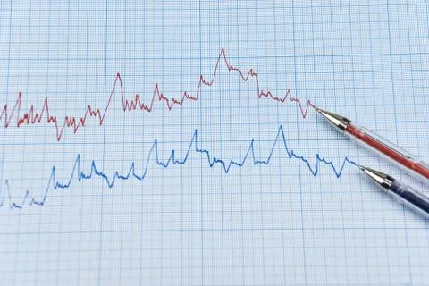 Falling stock chart Foto stock