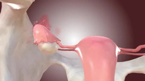 Fallopian tube allows the passage of an egg from the ovary to the uterus Video stock 245278757