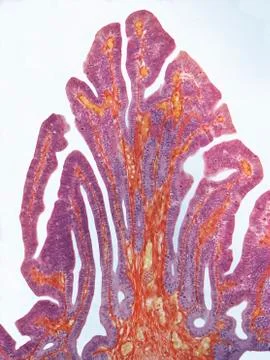 Fallopian tube, LM 스톡 일러스트