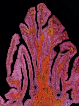 Fallopian tube, LM 스톡 일러스트