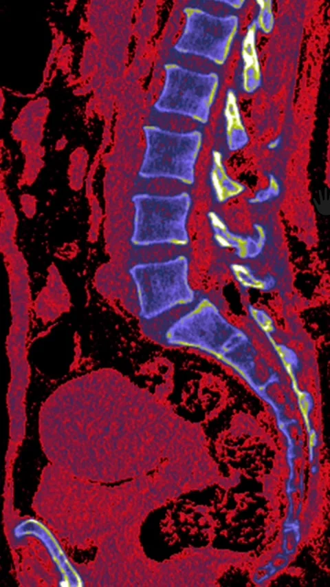 False Color Sagittal Head and Neck Scan Stock Footage 330954290
