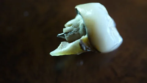 False Teeth extracted. Pulled out with bits of real tooth and metal. Macro close Vídeos de archivo 137338675