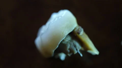 False Teeth extracted. Pulled out with real tooth and metal. Macro isolated. Stock Footage 137339682