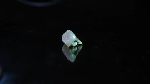 False Teeth pulled out. Extracted broken metal with bits of real tooth removed. Vídeos de archivo 137335002