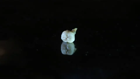 False Tooth pulled out. Extracted broken real tooth attached to metal. Close up. Stock Footage 137338158