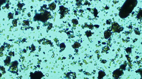 Farm Soil Bacteria Sample Stock Footage 24754854