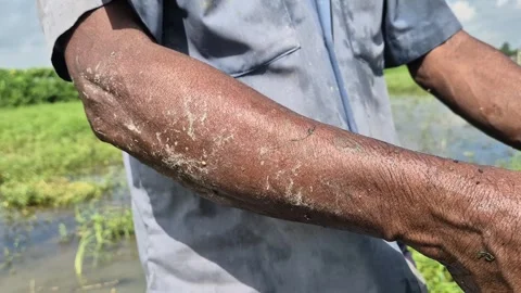 Farmer Arm Covered with Dried Mud Close Up Hardworking Rural Labor Video Stock Footage 343729898