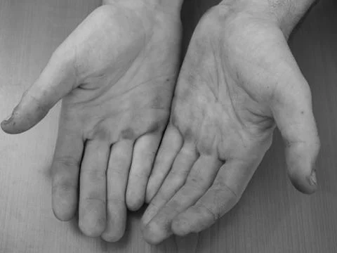 Farmer hands Stock Photos
