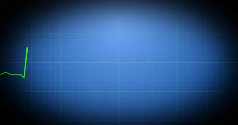 Fast Rhythm Stock Video Footage | Royalty Free Fast Rhythm Videos | Pond5