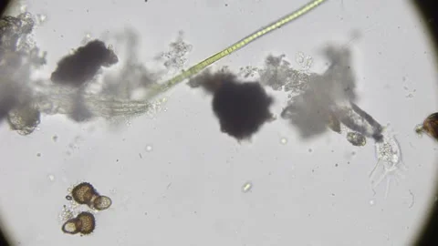 Fast motion timelapse of amoeba and other microorganisms moving in a drop o.. Stock Footage 308784580