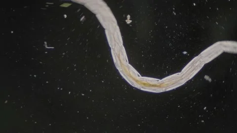 Fast moving nematode trematode worm under microscope dark field view Stock Footage 223454276