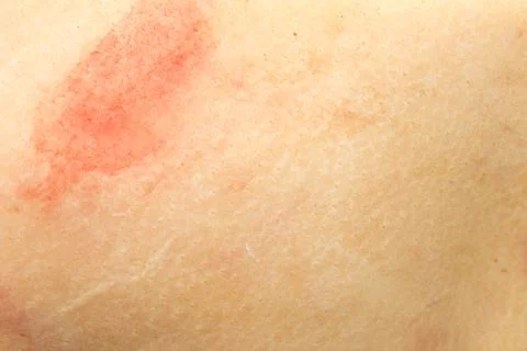 Fat as a background Stock Photos