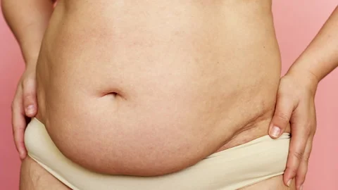 Close up of fat folds with big belly of , Stock Video