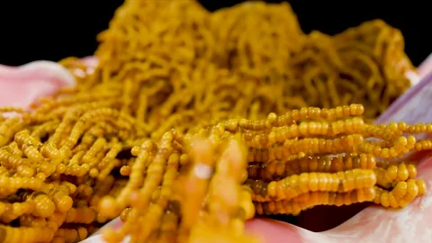 Fat Cell Growth Inside Human Body, Representing Obesity, Weight Gain Stock Footage 314207388