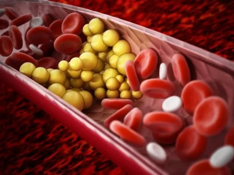 Fat cells blocking the blood flow inside human vein. 3D illustration Stock Illustration