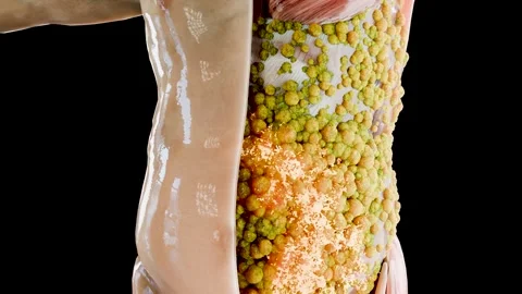 Fat cells burning process under the skin showing before and after effect Stock Footage 317296172