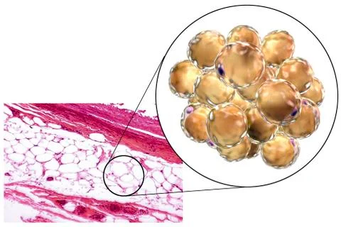 Fat cells, micrograph and 3D illustration Stockillustratie