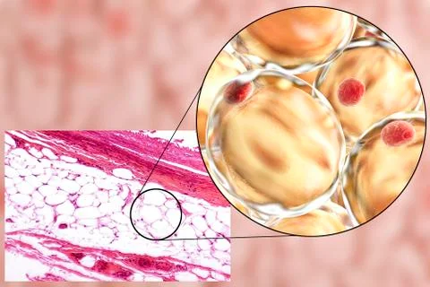 Fat cells, micrograph and 3D illustration Stock Illustration