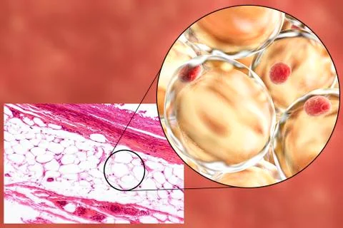 Fat cells, micrograph and 3D illustration Stockillustratie