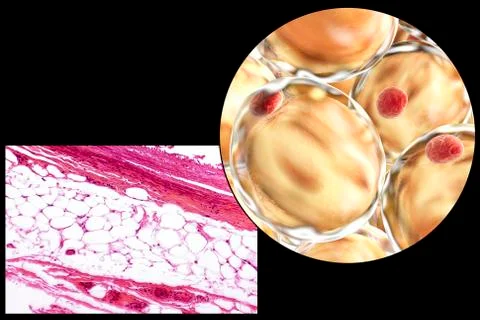 Fat cells, micrograph and 3D illustration Illustrazione stock