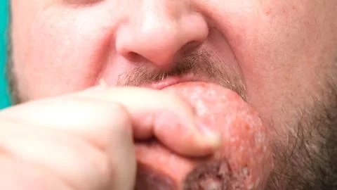 A fat chubby man with a beard eats sausage or meat, a concept of harmful Stock Photos