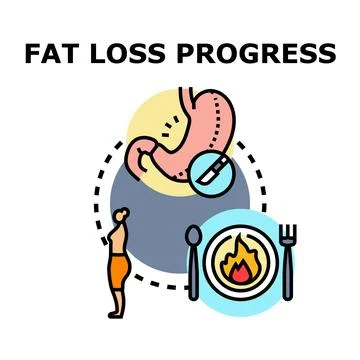 Fat loss progress with diet and stomach surgery Stock Illustration