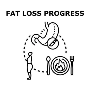Fat loss progress with diet and stomach surgery Stock Illustration