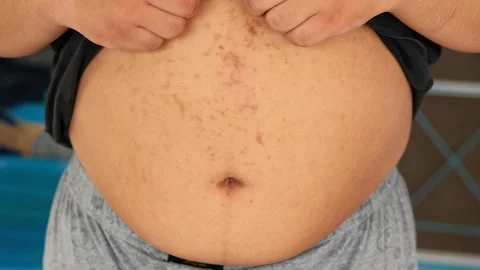 Fat men have a belly because they eat foods high in fat. Stock Footage 149826530