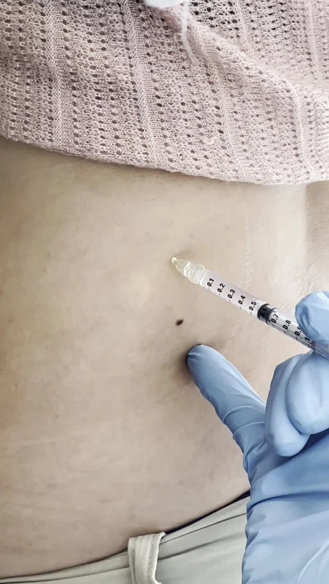 Fat Reduction Injection 4K Close-Up Aesthetic Clinic Treatment with Needle Stock Footage 311091029