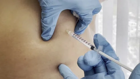 Fat Reduction Injection 4K Close-Up Aesthetic Clinic Treatment with Needle Stock Footage 311091030