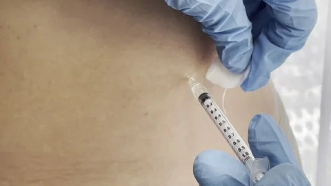 Fat Reduction Injection 4K Close-Up Aesthetic Clinic Treatment with Needle Stock Footage 311091031