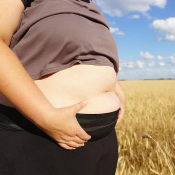 Cropped Image of Overweight Fat Woman Tummy, Losing Weight, Excess