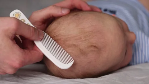 Father with comb removing cradle cap of seborrheic dermatitis of baby's head. Stock Footage 282020874