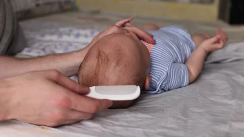 Father gently removing cradle cap of seborrheic dermatitis of baby's head. Stock Footage 282020792