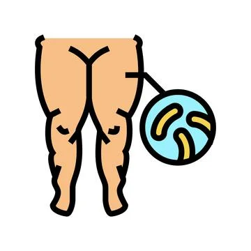 Fatty edema color icon vector illustration Stock Illustration