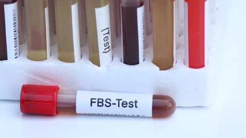 FBS test to look for abnormalities from ... | Stock Video | Pond5
