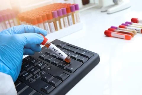 FBS test to look for abnormalities from blood Stockfoto's