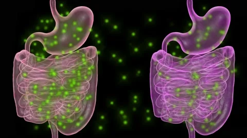 Fecal transplant . 3d animation rendering Stock-Footage 141482325