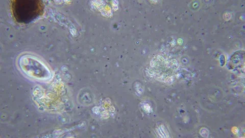 Feeding ciliate in sewage under Phase contrast Microscope Video stock 80429688