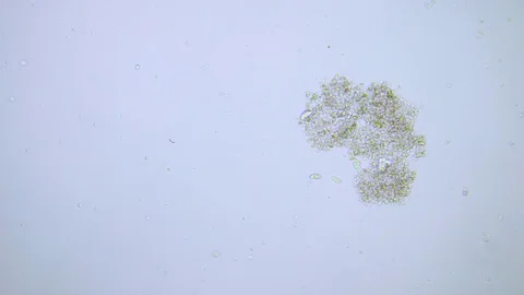 Feeding ciliate under Bright field Microscope Video stock 80364251