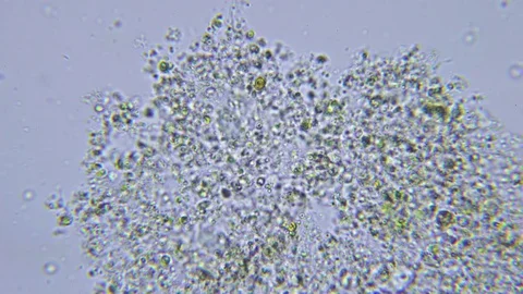 Feeding ciliate under Bright field Microscope Video stock 80365638