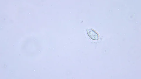Feeding ciliate under Bright field Microscope Video stock 80369622