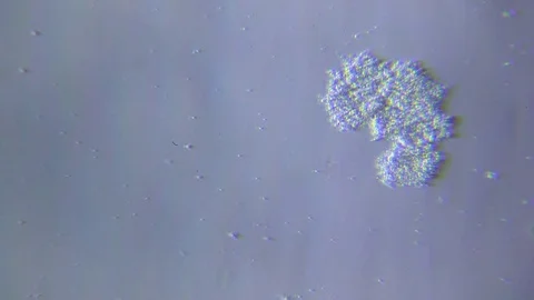 Feeding ciliate under Oblique light Microscope Video stock 80363015